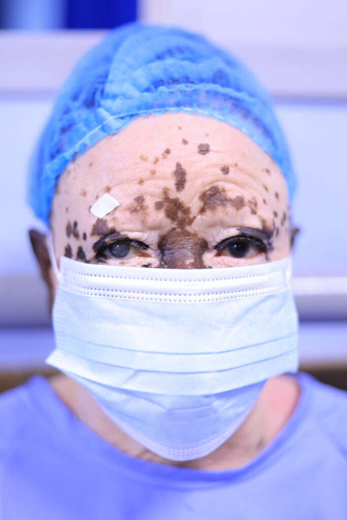 Herona Community Hospital Completes Its Free Cataract Surgeries for 2025