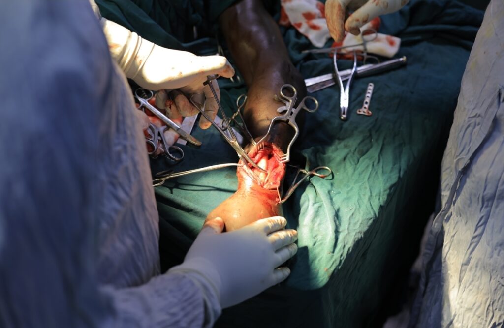 Successful Orthopaedic Surgery Restores Wrist Function at Herona Community Hospital Successful Orthopaedic Surgery Restores Wrist Function at Herona Community Hospital